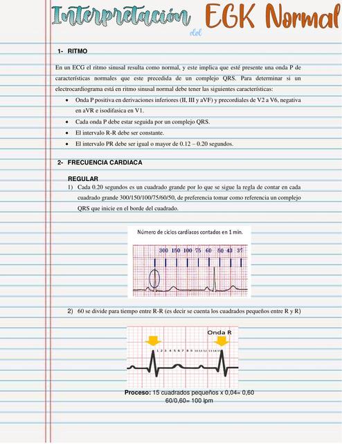 Interpretación del EKG