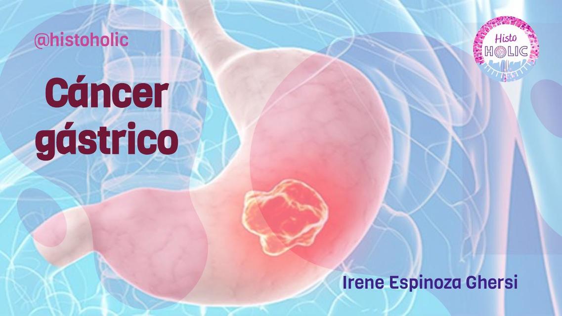 Cáncer gástrico 