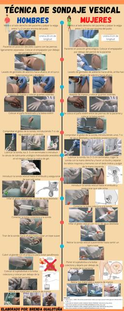 Técnica de sondaje vesical