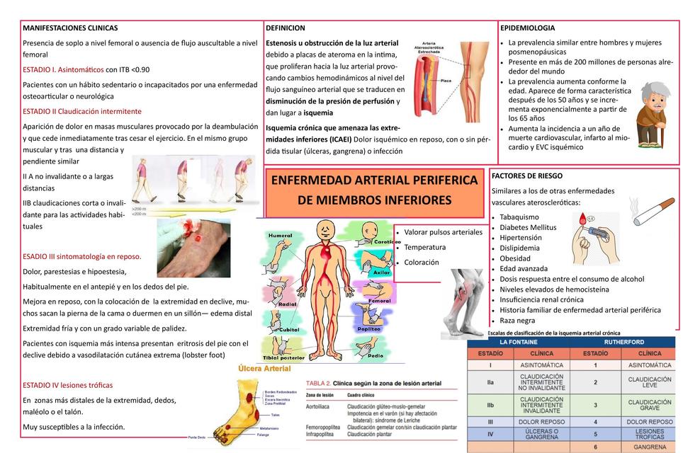 Insuficiencia Arterial