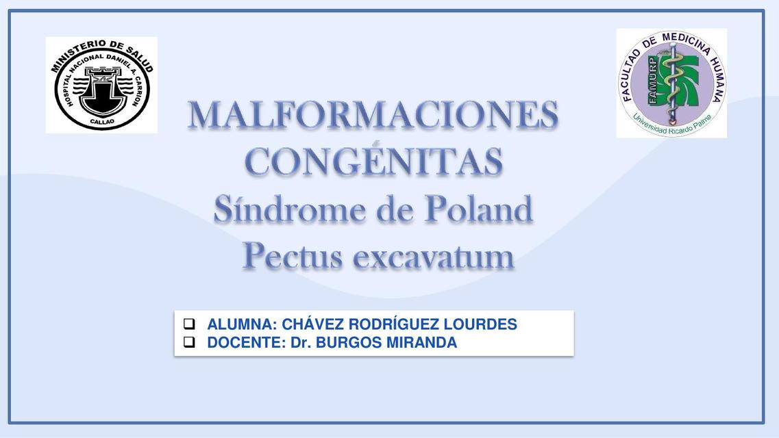 Sindrome de Poland