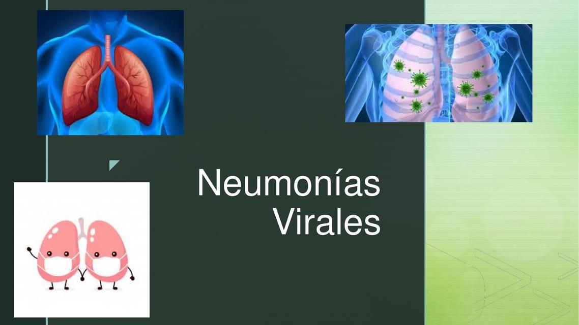 Neumonia viral