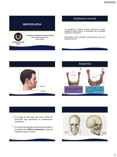 Mentoplastia