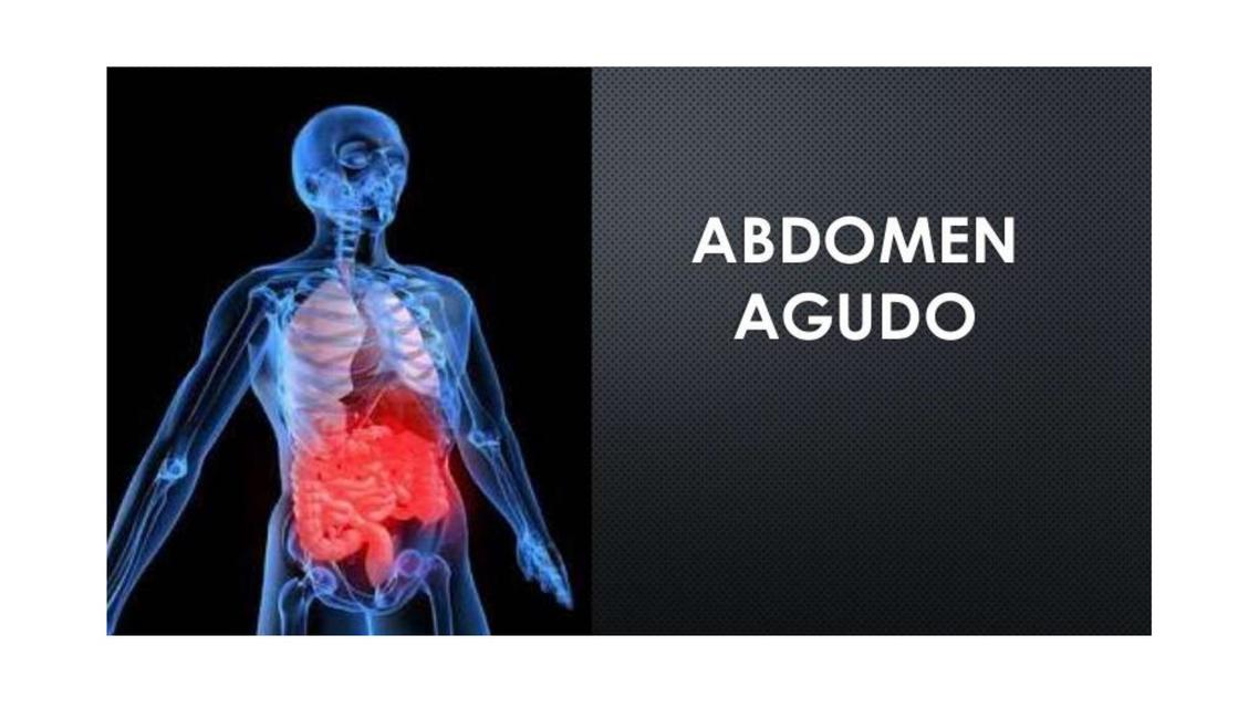 ABDOMEN AGUDO