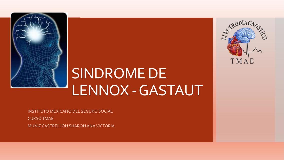 Síndrome de Lennox Gastaut