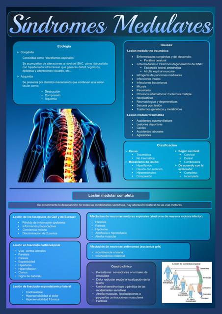 Sindrome medular