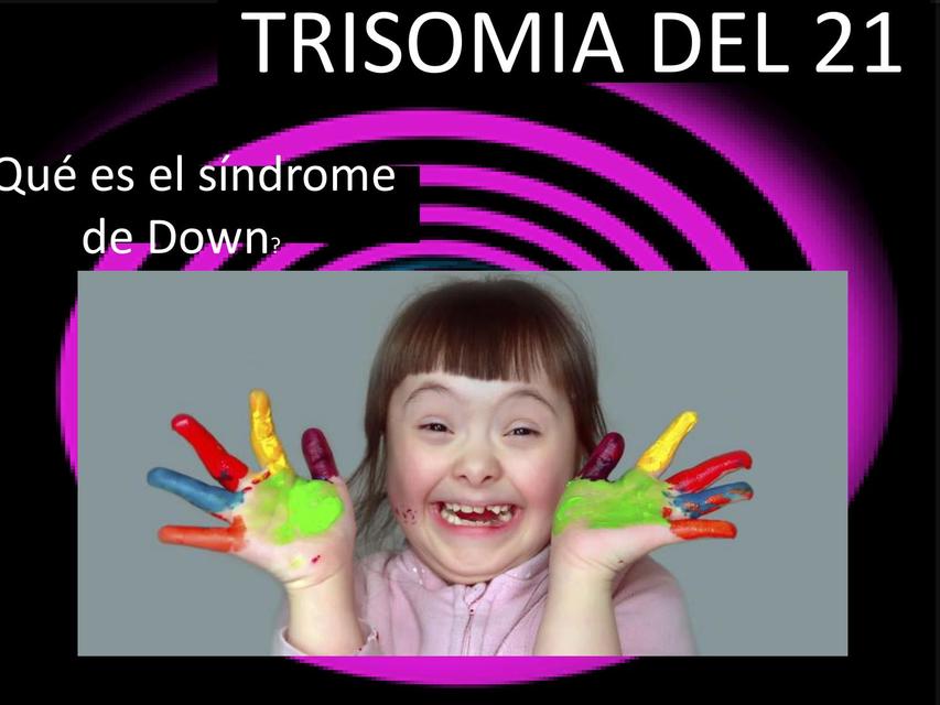 Trisomia