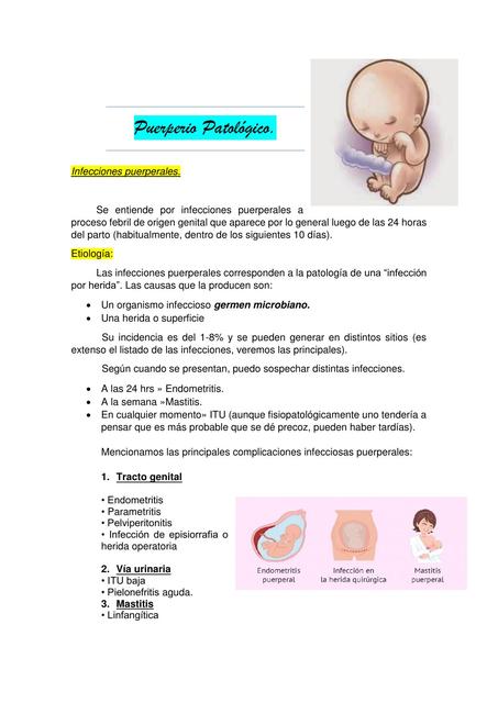 Endometritis Puerperal