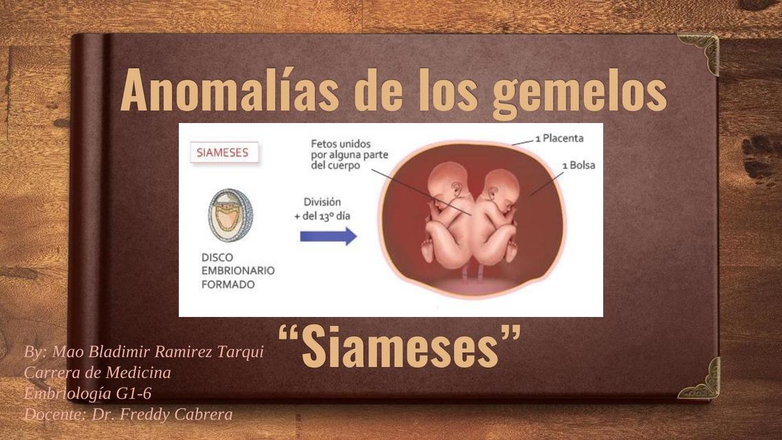 Anomalias de los gemelos