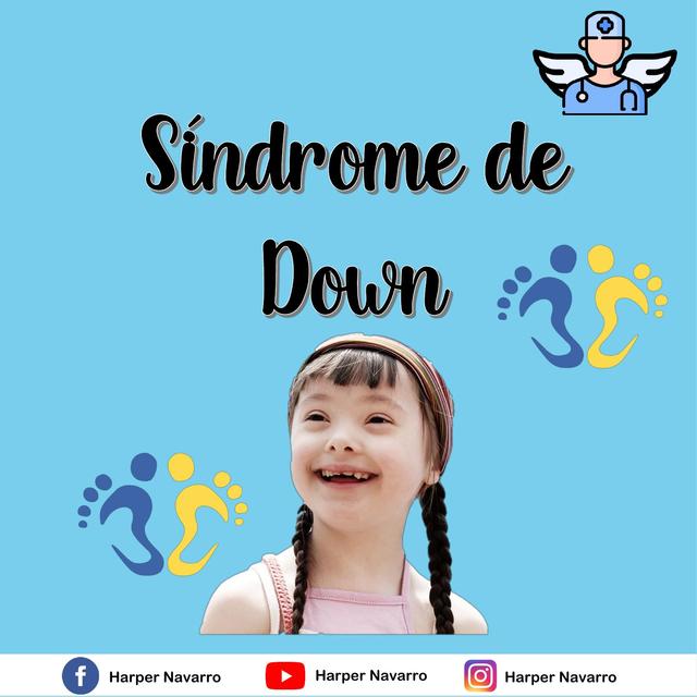 Síndrome De Down Medicina Harper Navarro Udocz