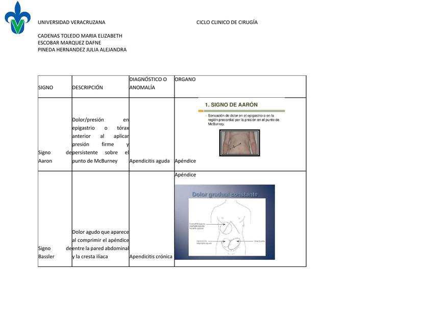 Signos de Abdomen Agudo