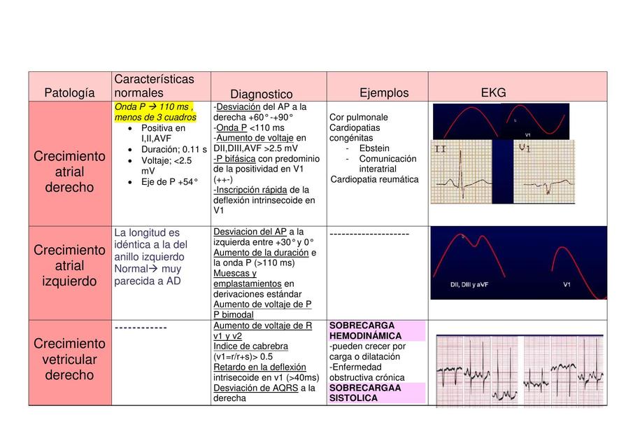 Crecimientos ventriculares