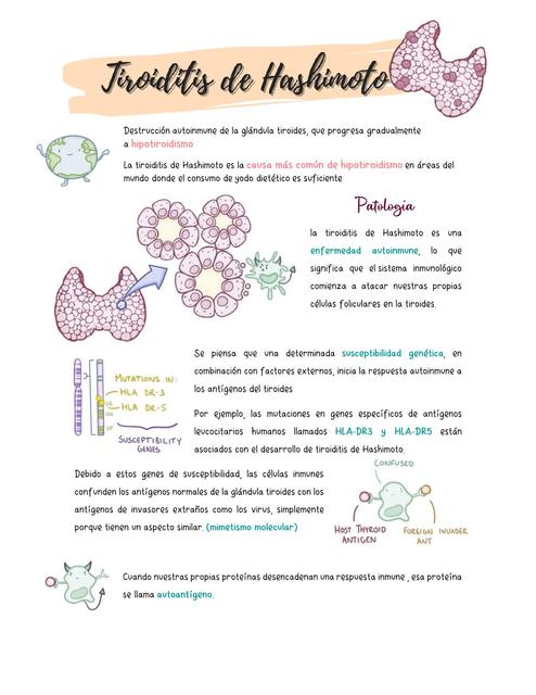 tiroiditis hashimoto