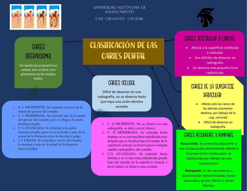 Clasificación Caries