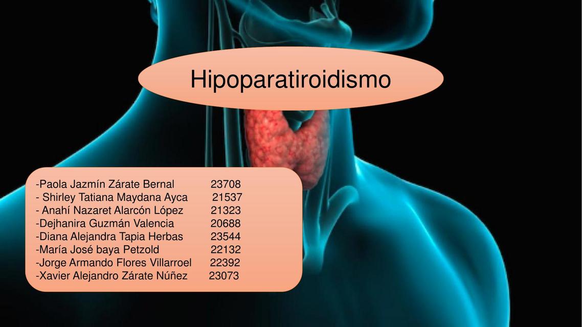 Hipoparatiroidismo