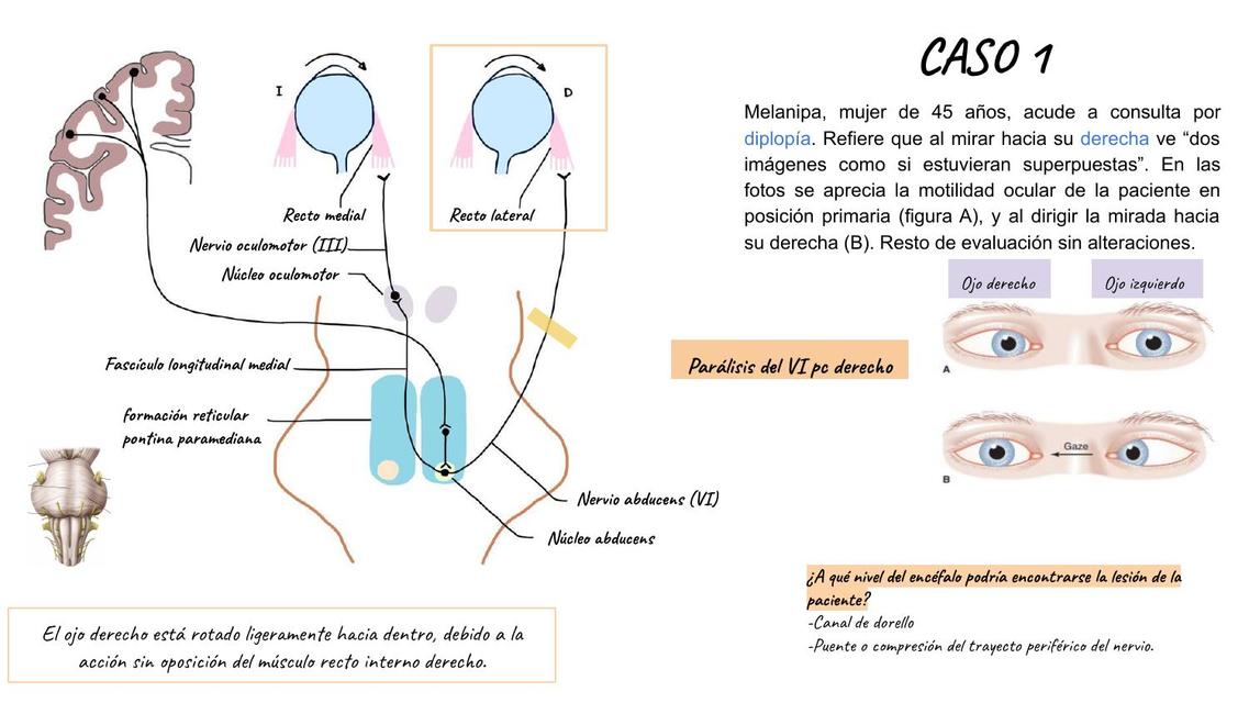 Caso Clínico de Sistema Nervioso