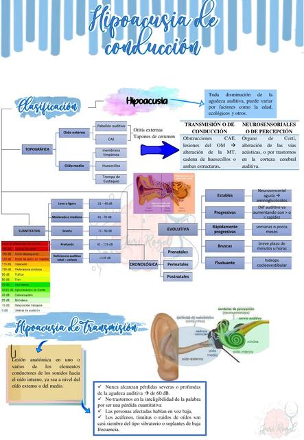 Resumen Hipoacusia de Transmisión o conducción