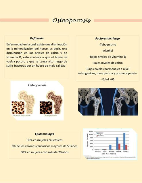 Osteoporosis