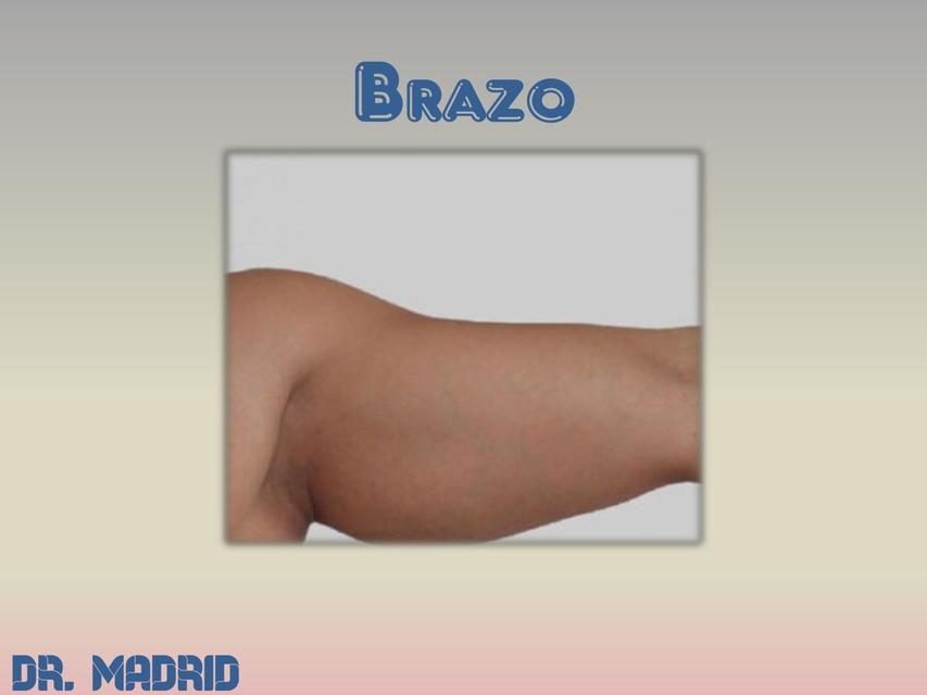 Brazo