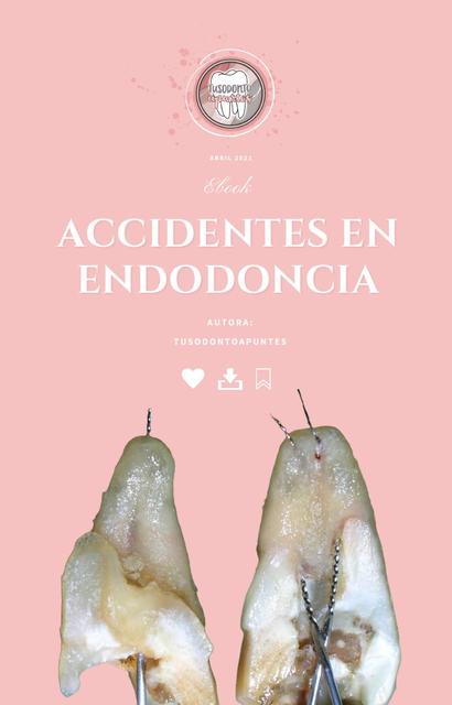 Endodoncia en dientes monradiculares