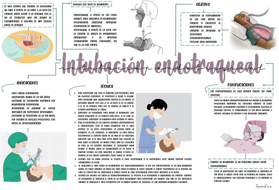 Intubación Endotraqueal