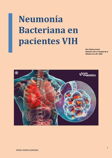 Neumonía Bacteriana