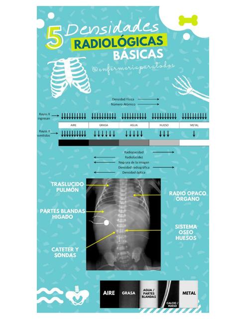 5 densidades radiológicas