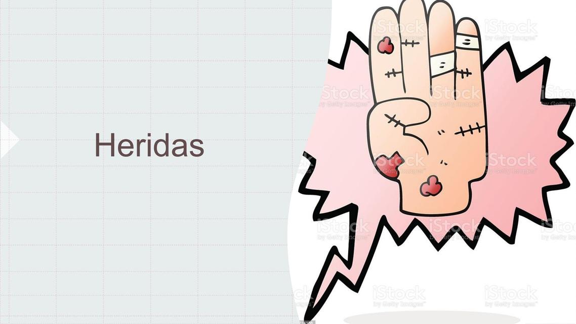 Heridas