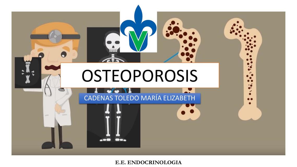 Osteoporosis