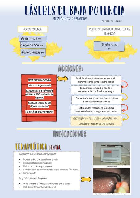 Láser de Baja Potencia en Odontología