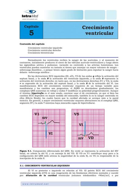 Crecimiento Ventricular