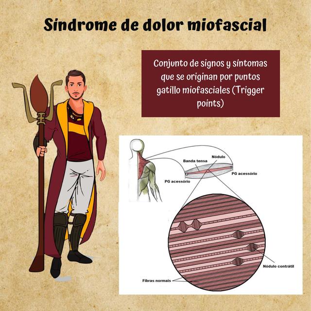 Síndrome De Dolor Miofascial