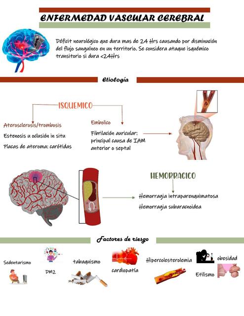 Enfermedad vascular cerebral