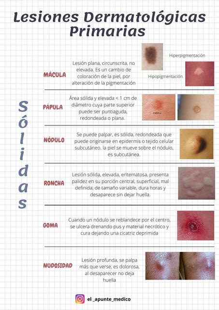 Lesiones Dermatol gicas Primarias El apunte medico UDocz