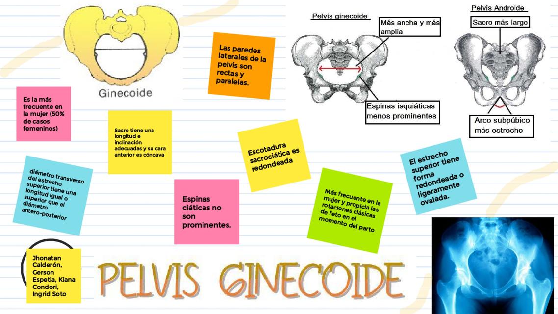 Pelvis Ginecoide