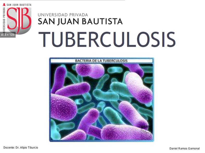 Tuberculosis