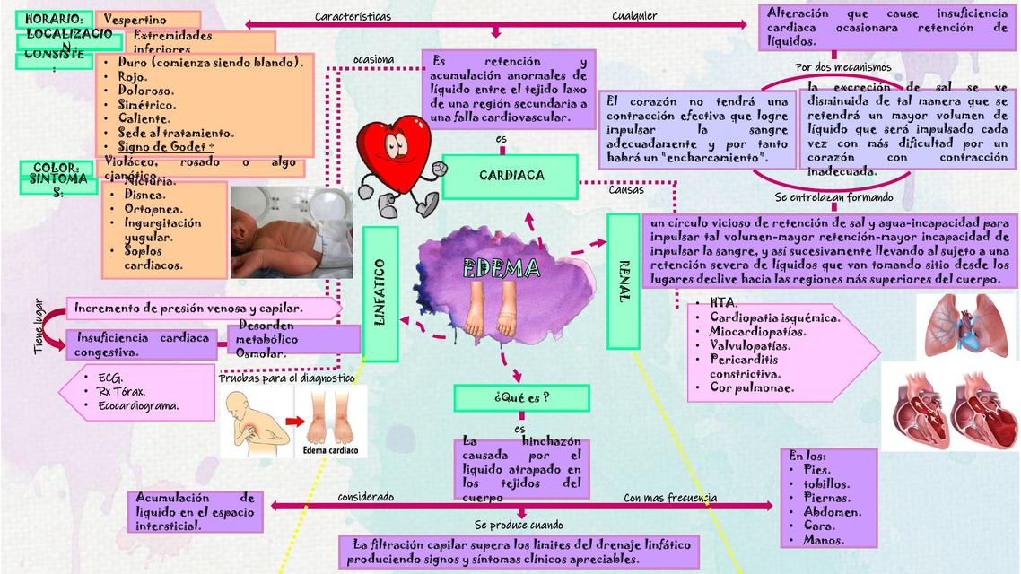 Edema 