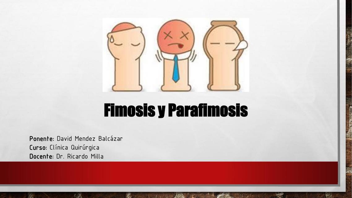 Fimosis y Parafimosis