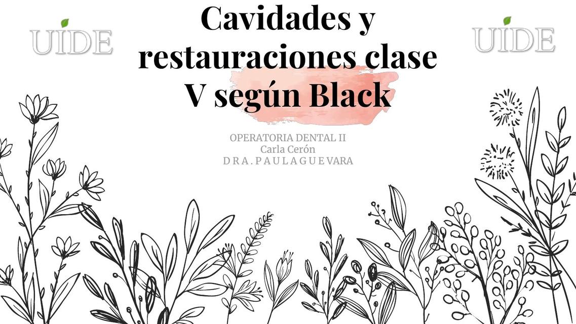 Cavidades y restauraciones clase V según Black