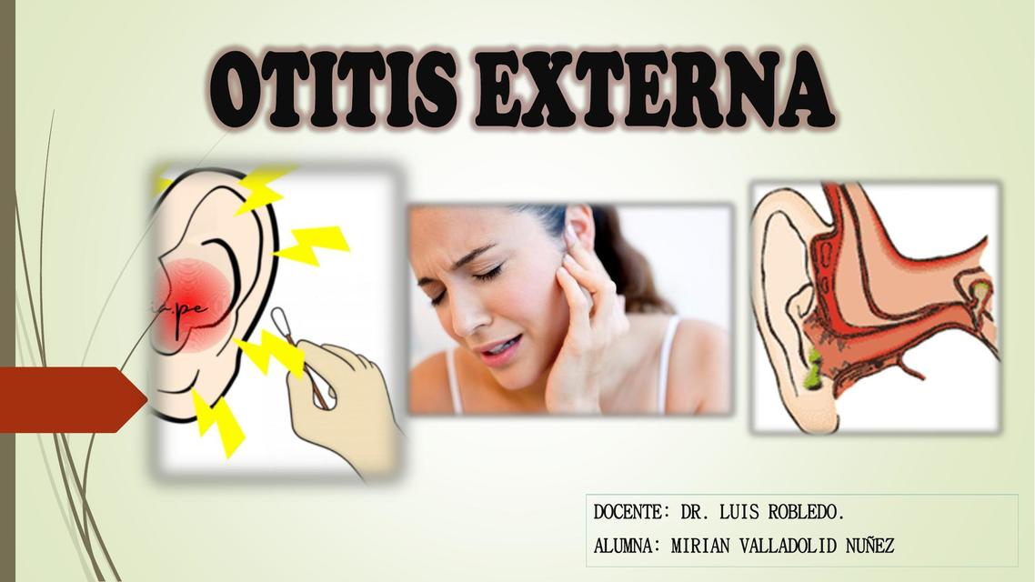 Otitis Externa 