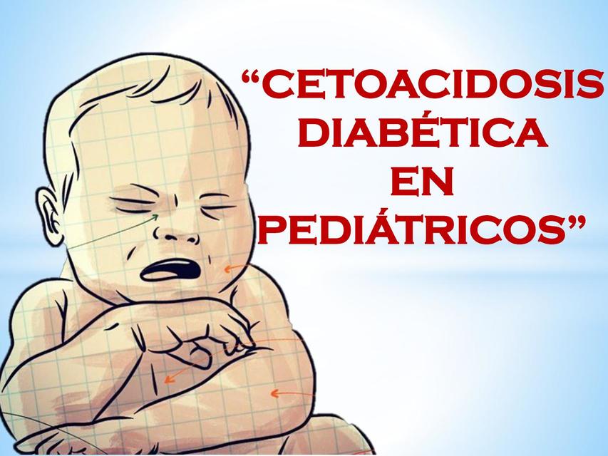 Cetoacidosis Diabética en Pediátricos 