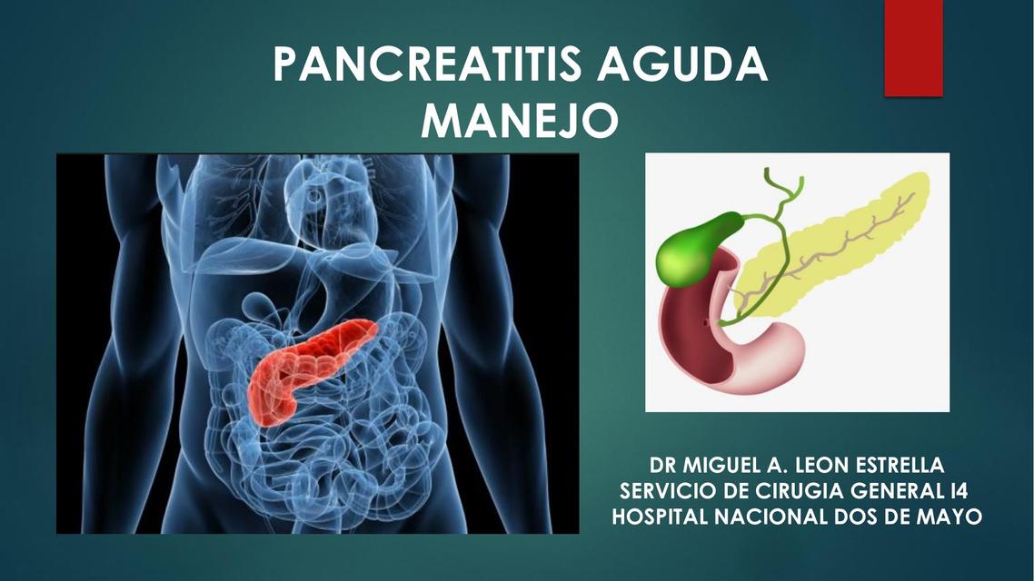 Pancreatitis Aguda 