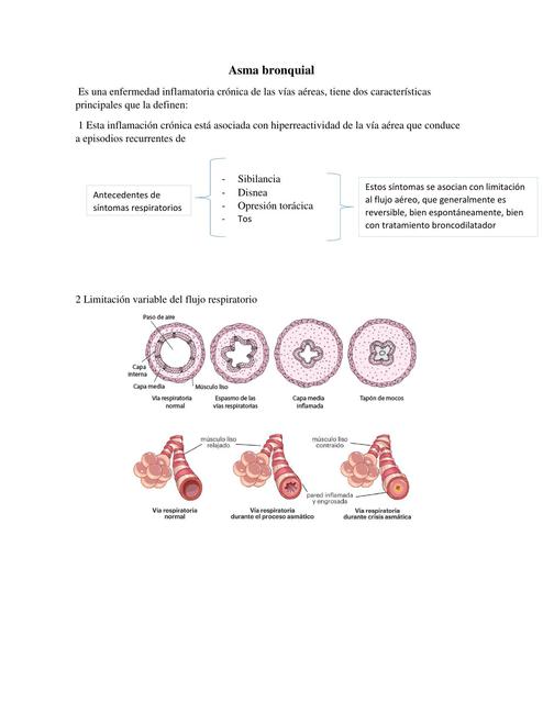 Asma Bronquial