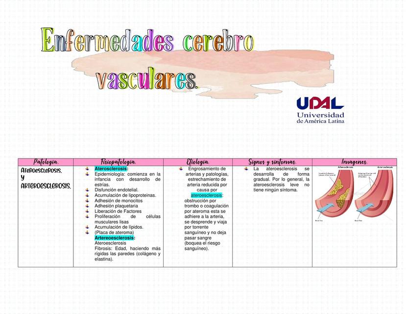 Enfermedades cerebro vasculares