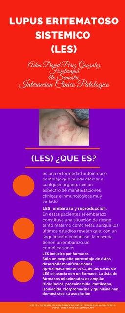 Lupus Eritematoso Sistémico 