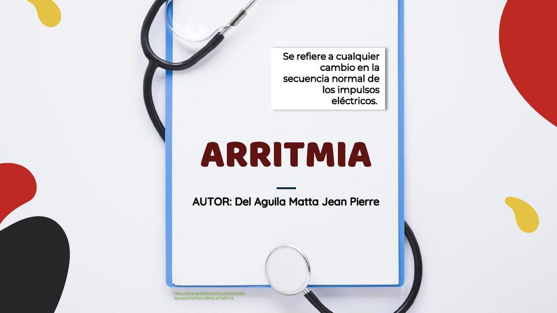 Arritmia 