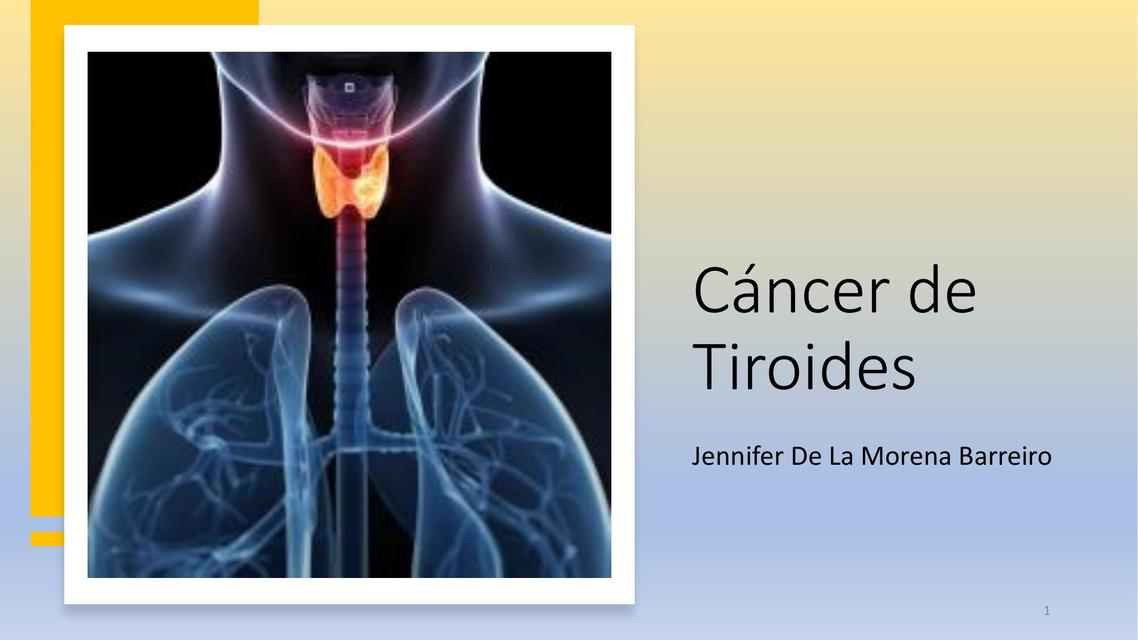 Cáncer de Tiroides