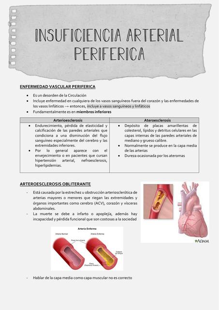 Insuficiencia Arterial Periférica