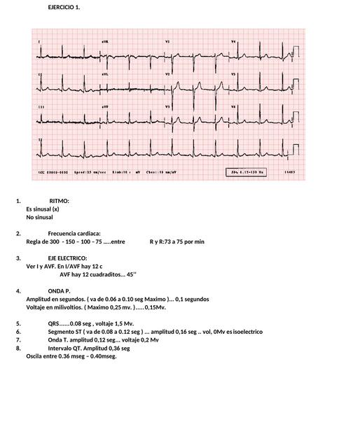 Trabajo de Cardiología