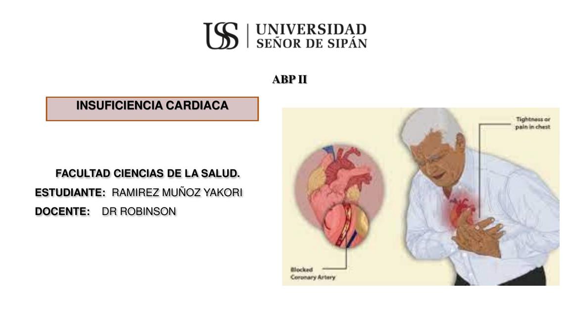 Insuficiencia cardiaca presentación 